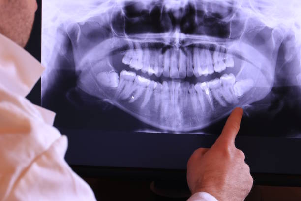 Best Emergency Root Canal Treatment in Frankfort, MI